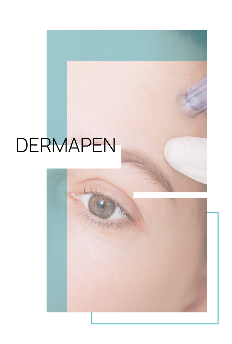 dermapen