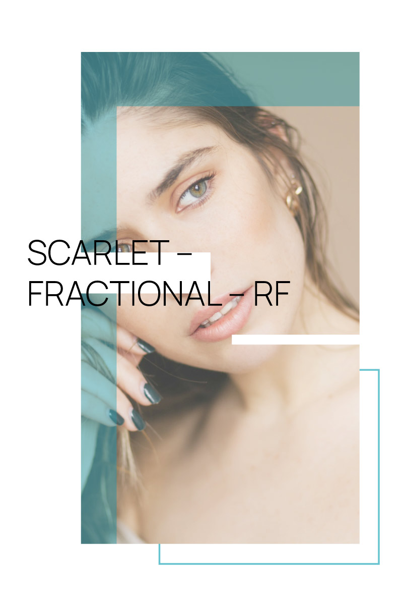 fractional rf